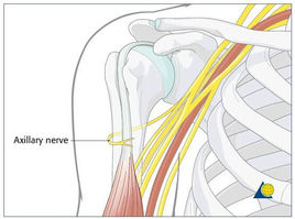 腋神经损伤是什么症状和表现用中医来解释