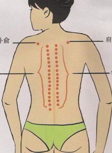 腰背肌肉筋膜炎是什么症状和表现用中医来解释