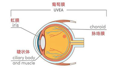 虹膜睫状体炎是什么症状和表现用中医来解释