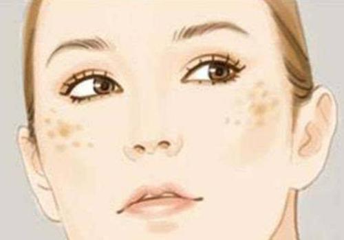 面部色斑是什么症状和表现用中医来解释