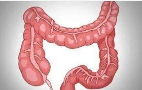 胃、十二指肠溃疡为什么会穿孔?