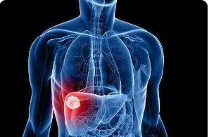 病毒性肝炎病人为什么肝脏肿大?
