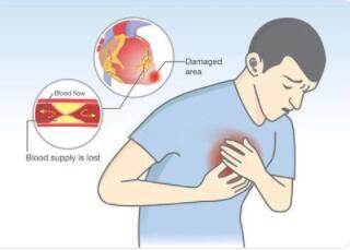 胸痛是怎么产生的?常见的原因有哪些?