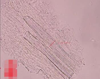 干姜的显微镜鉴别图片
