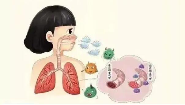 我们该怎样保护我们的呼吸器官?